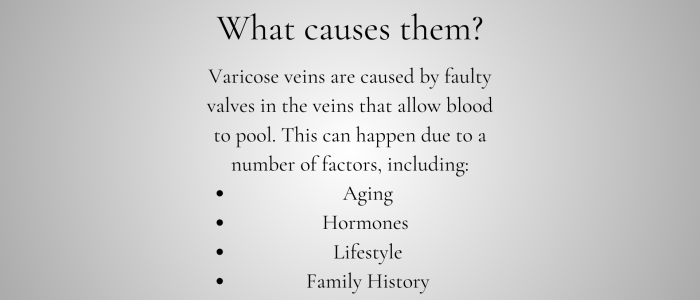Varicose Veins WP (2)