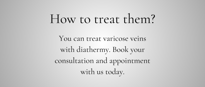 Varicose Veins WP (3)